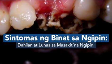 sintomas ng binat sa bagong bunot ng ngipin